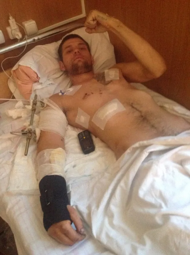 Айдарівцю з Івано-Франківська потрібна допомога. У нього двічі зупинялося серце, але він вижив — фото 1