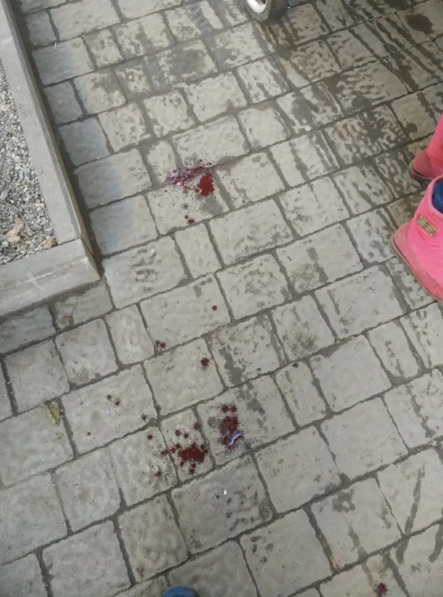 Дівчину ледь не вбив шматок карнизу, що відвалився із старого будинку (Фото) — фото 3