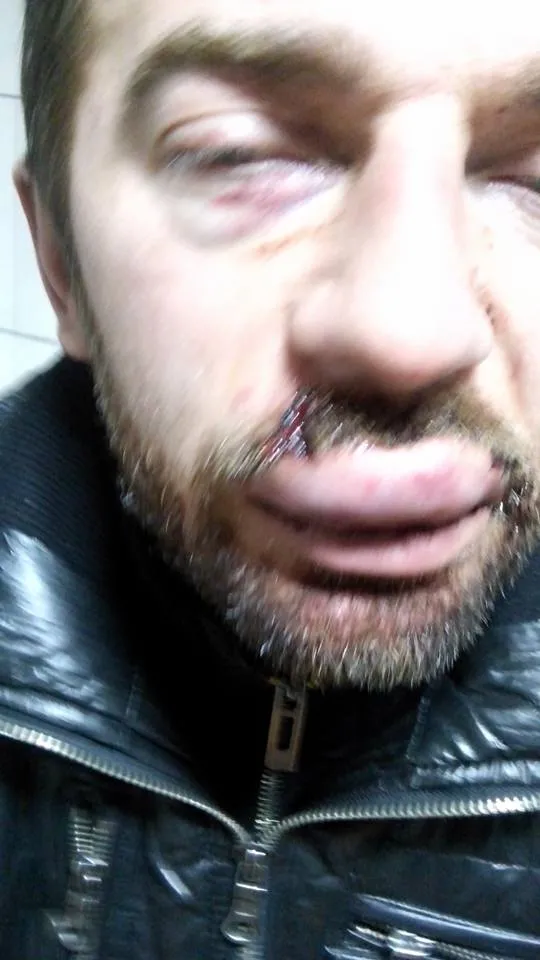 Троє п'яних франківських прокурорів жорстоко побили фронтмена гурту «ПАТРІОТ.UA» (фото) — фото 2