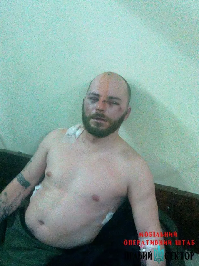 В мережі з'явилися фото побитих на Драгобраті прикарпатських бійців «Правого сектору» (фото) — фото 5