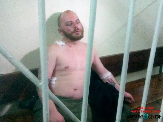 В мережі з'явилися фото побитих на Драгобраті прикарпатських бійців «Правого сектору» (фото) — фото 6
