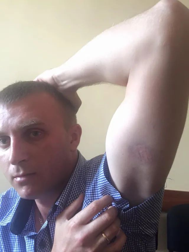 Дмитро Міхалець побив ветерана АТО. На прес-конференції обидві сторони розповіли свої версії подій — фото 1